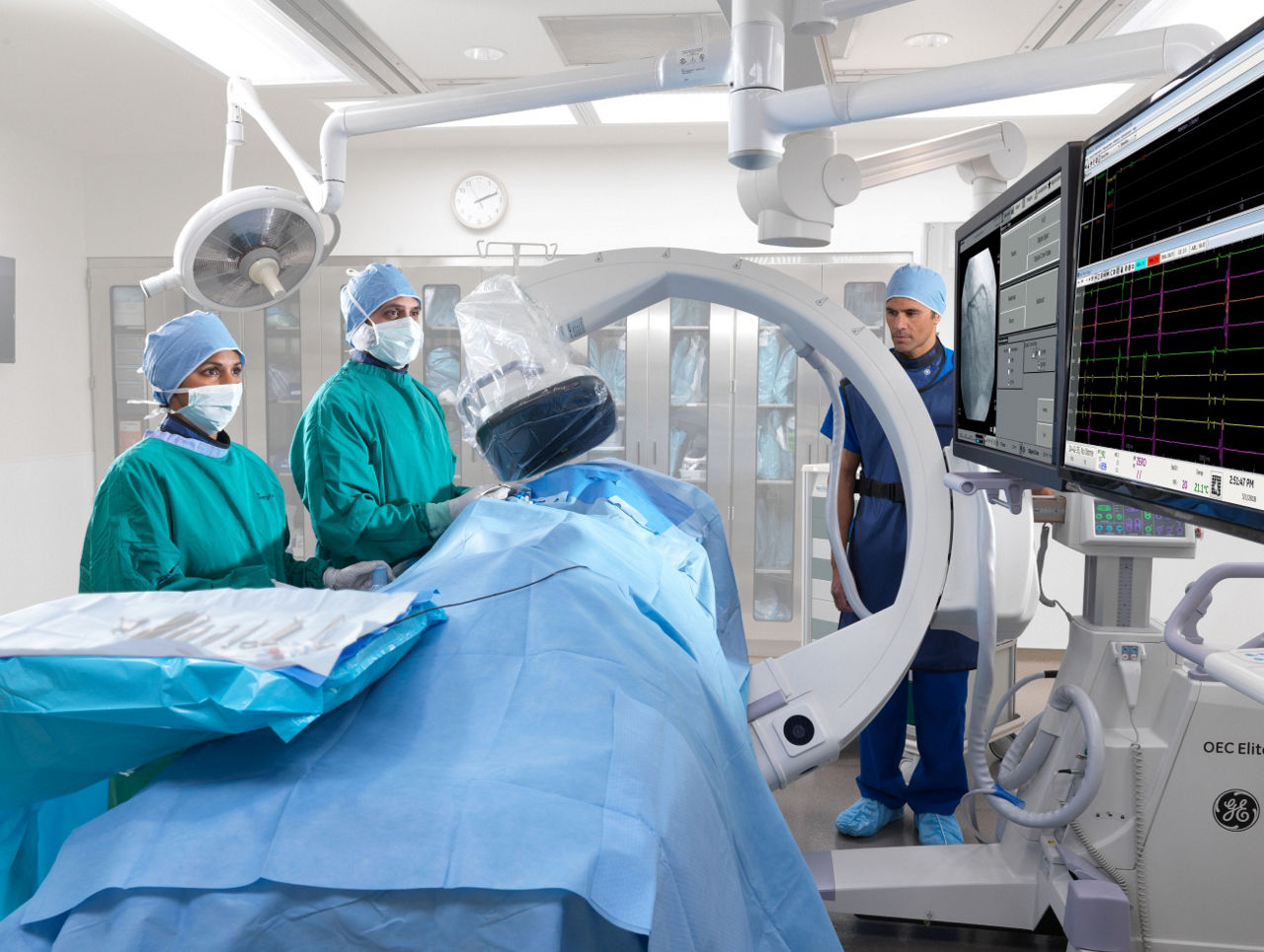 c-arms-for-cardiac-smooth-s-curve-st-en
