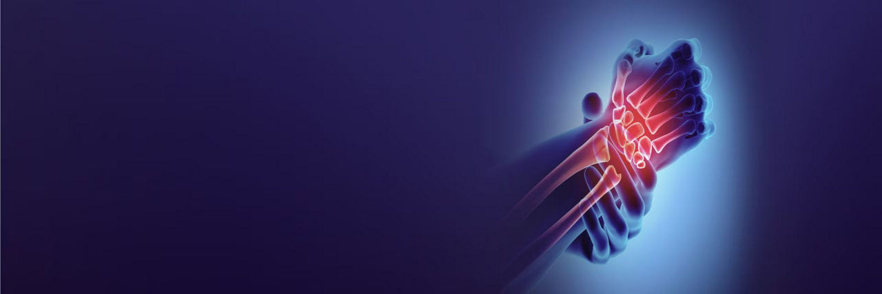 c-arms-for-extremities-promo-dynamic-ba-en