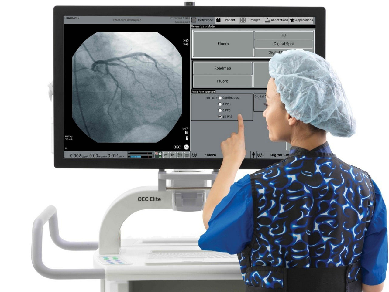 c-arms-for-vascular-imaging-clear-st-en