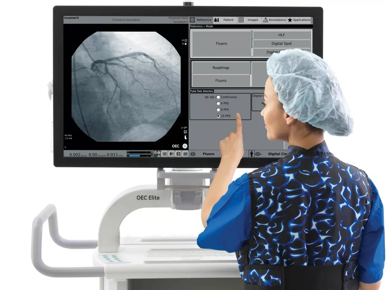 c-arms-for-vascular-imaging-clear-st-en