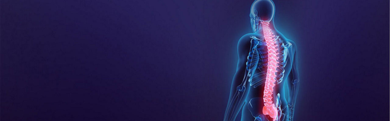 c-arms-pain-management-PromoDynamicHighlight-updated-ci-en