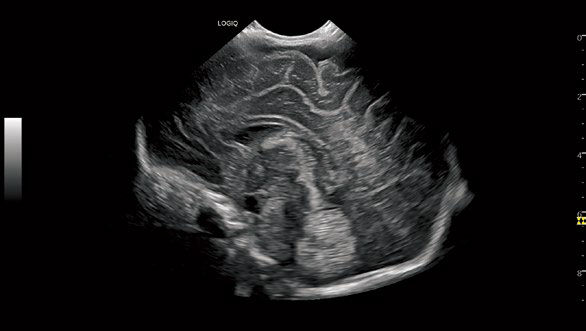C3-10-D_