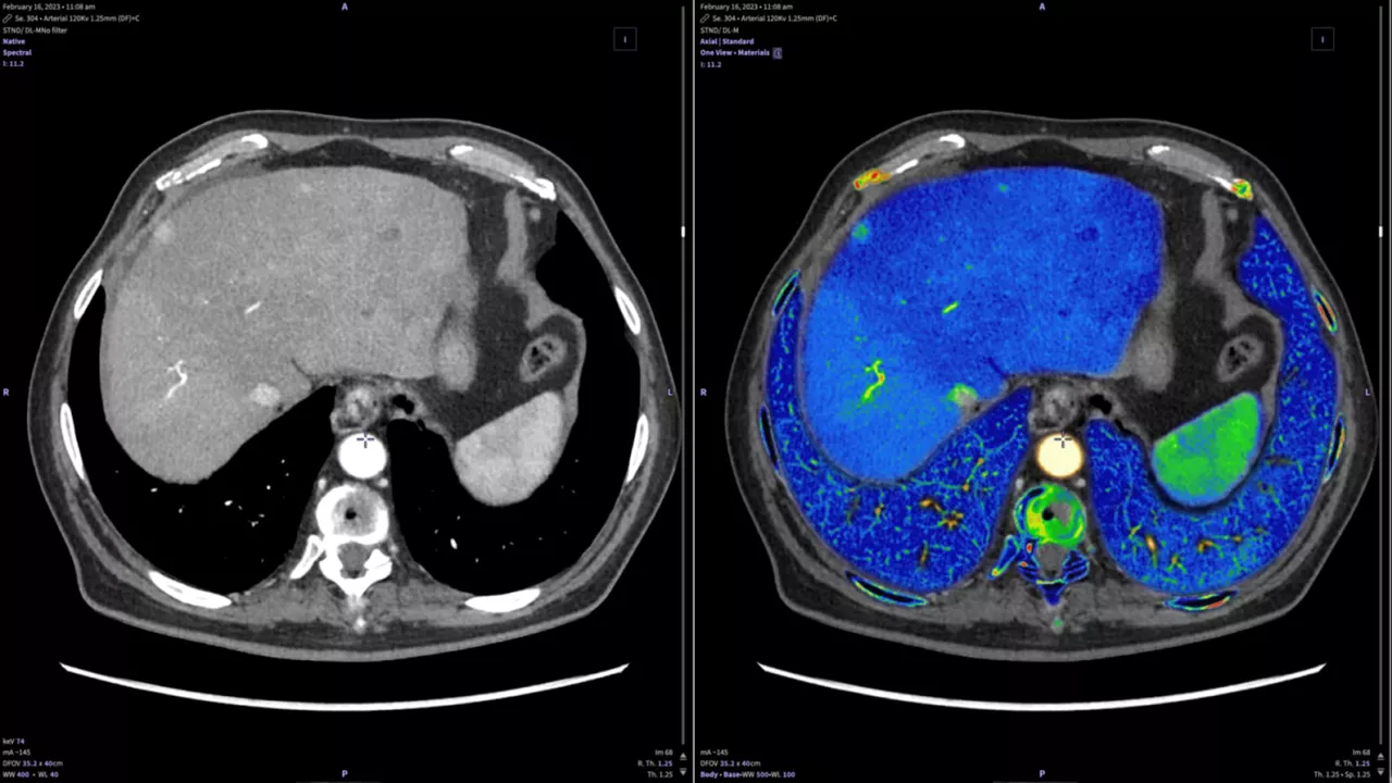 image of a new device versa viewer