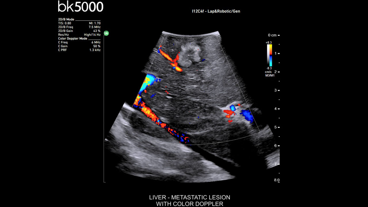 card4-half-width-minimally-invasive-surgery-ultrasound