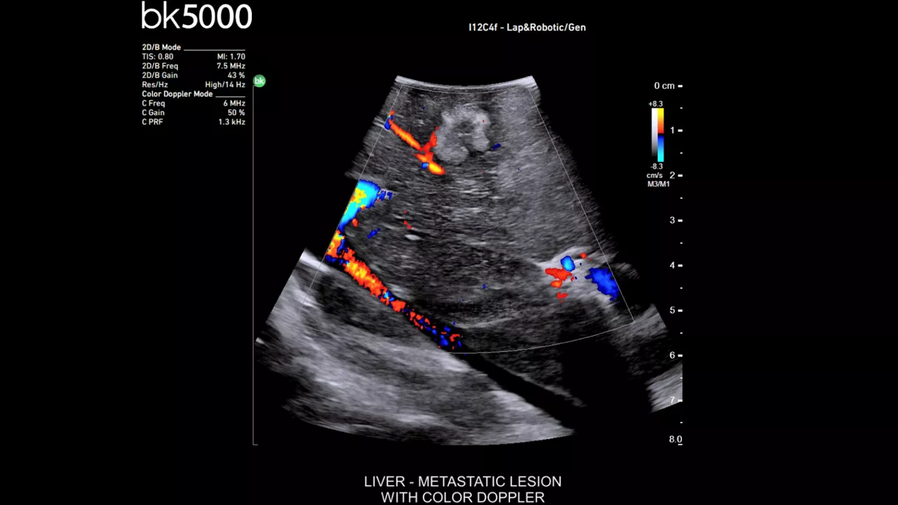 card4-half-width-minimally-invasive-surgery-ultrasound