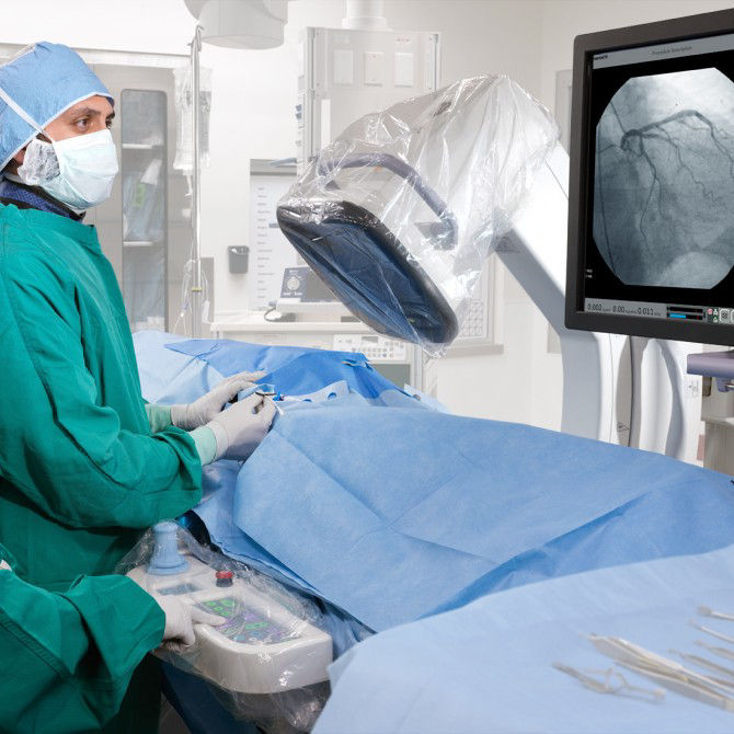 c-arms-for-cardiac-surgery