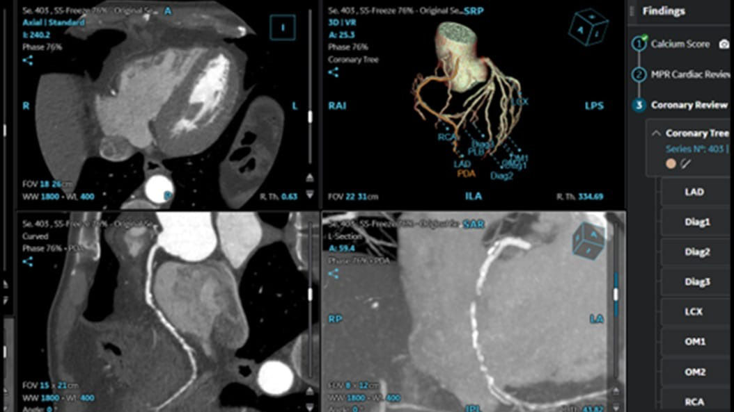 cardiac-ct-aw-applications-2-ci-en