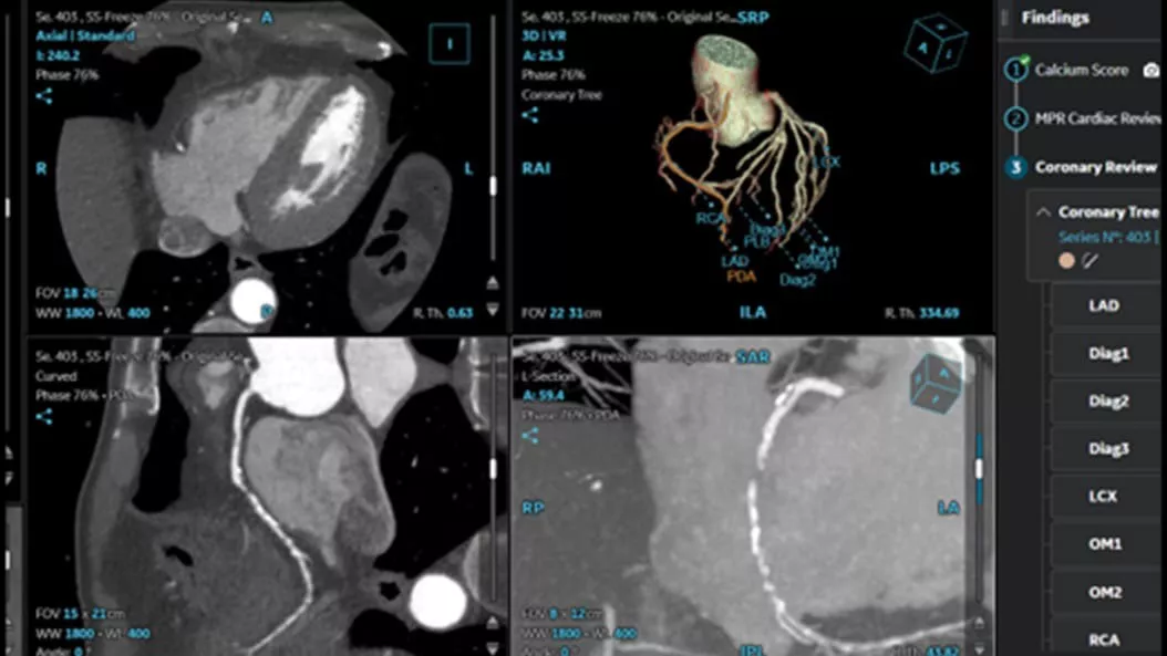 cardiac-ct-aw-applications-2-ci-en