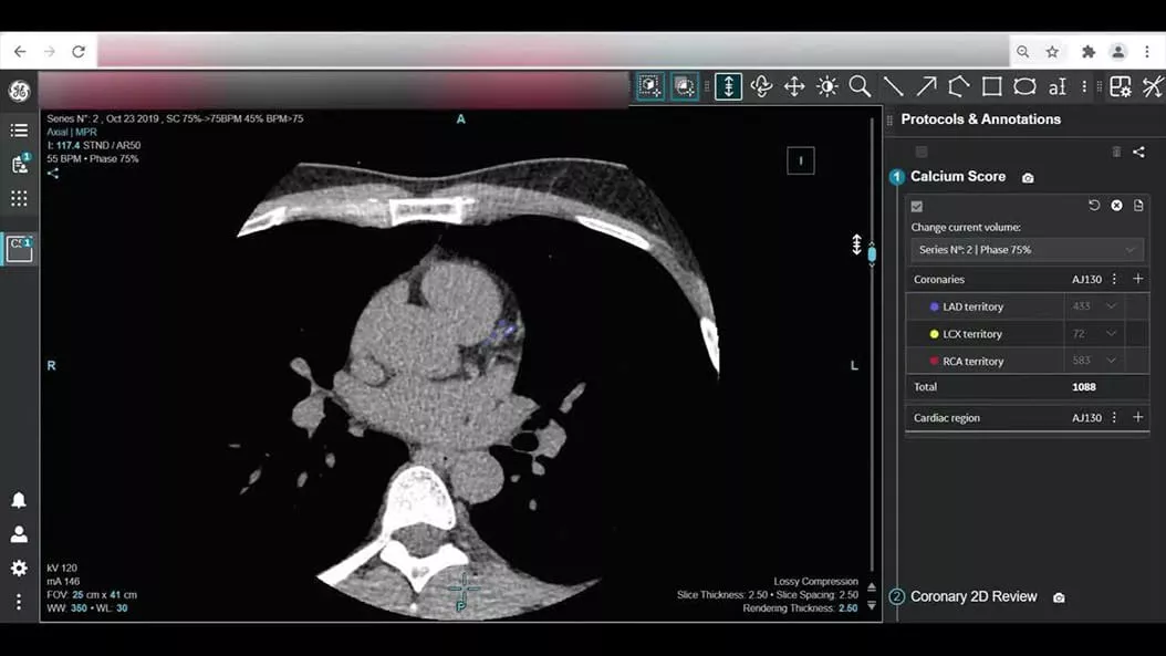 cardiac-ct-cardiq-suite-1-ci-en