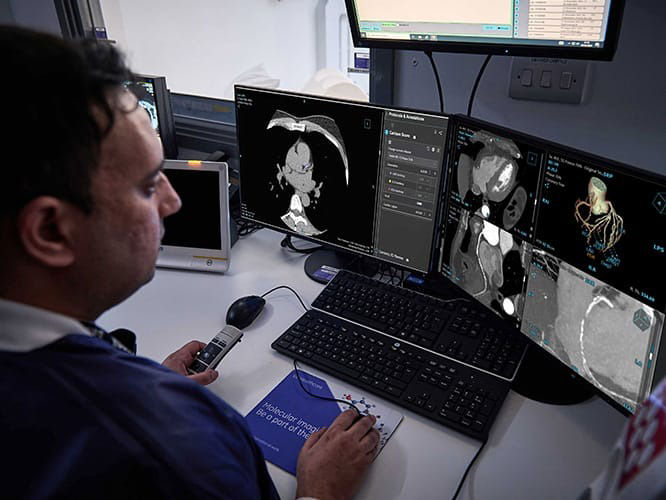 cardiac-ct-s-curve-standardized-quality-st-en