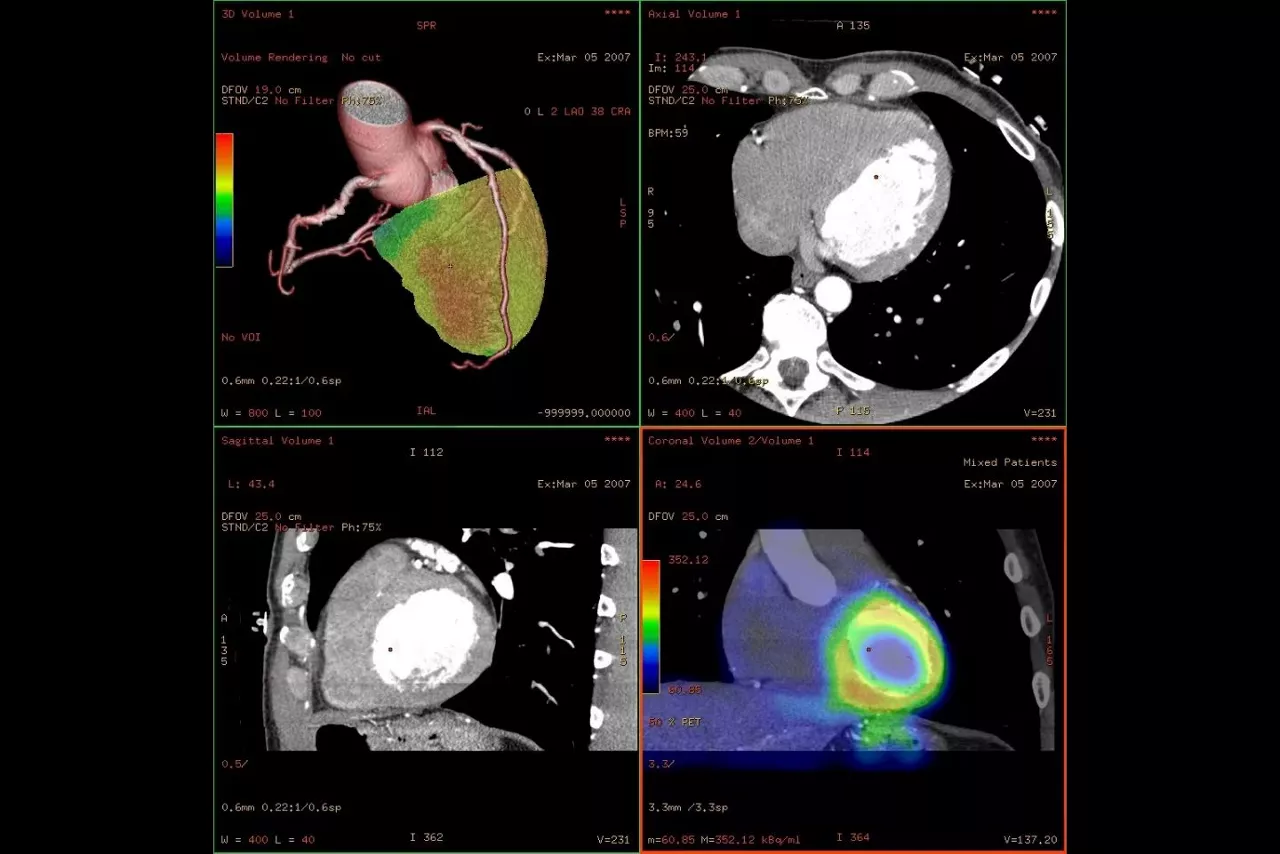 cardiac-evaluation-desktop-ci-en