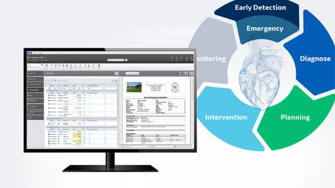 Cardiac info management
