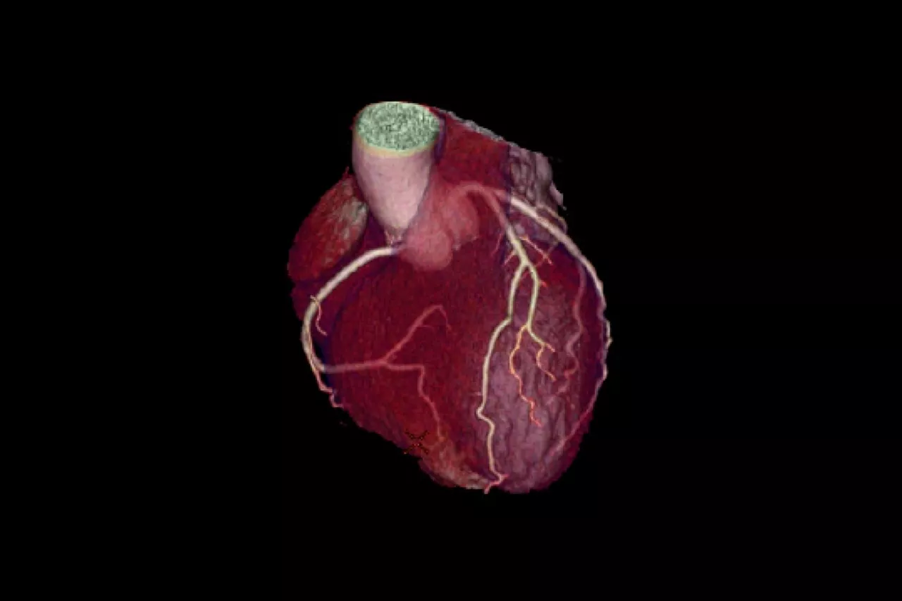 cardiac-post-scan