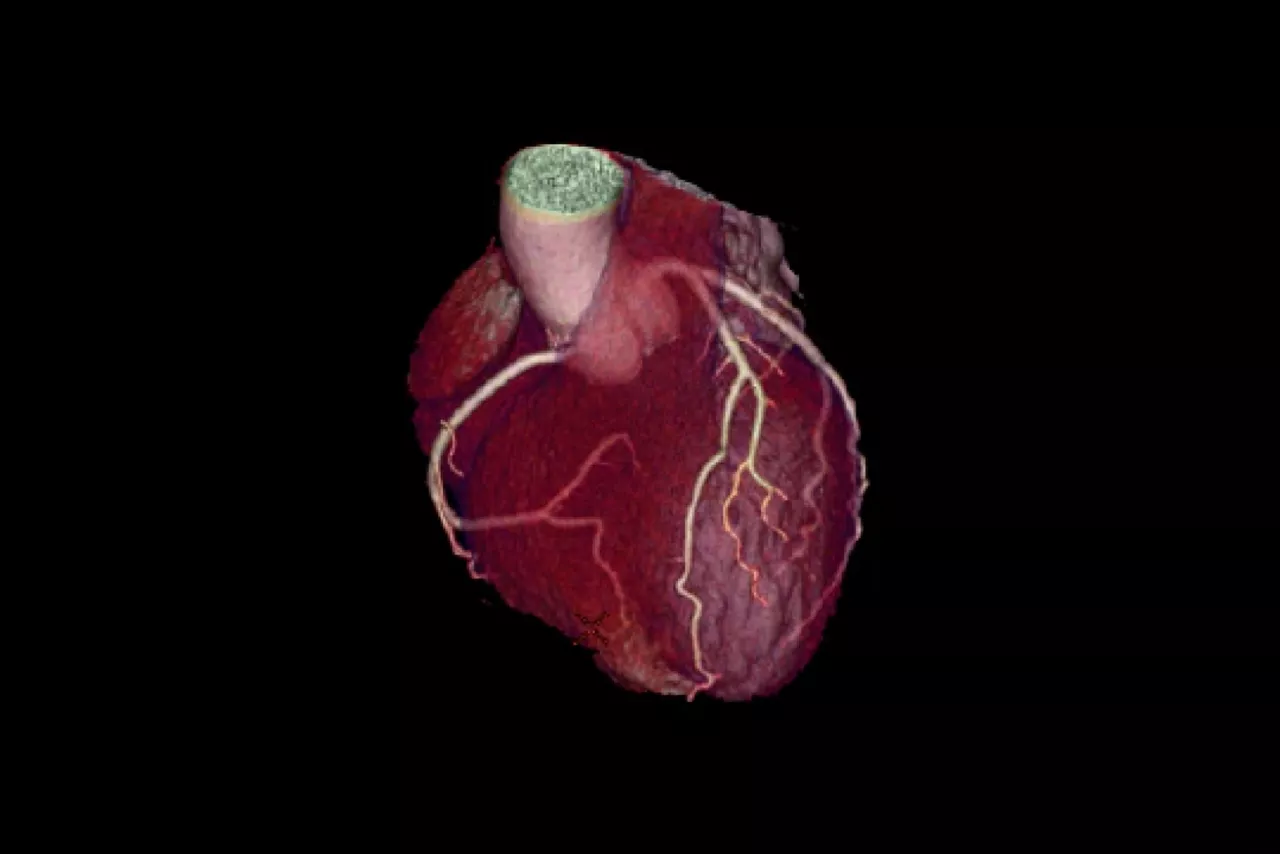 cardiac-post-scan
