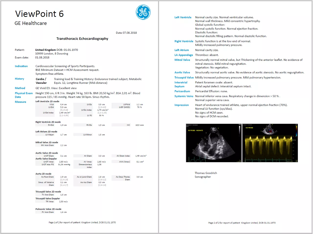 cardio report page 1 v1