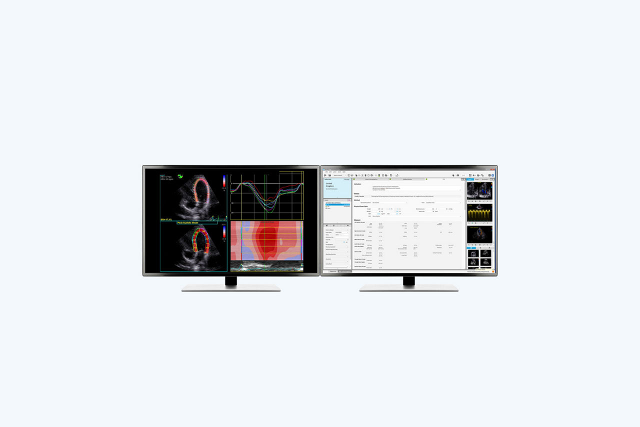 cardio1-feature-hero