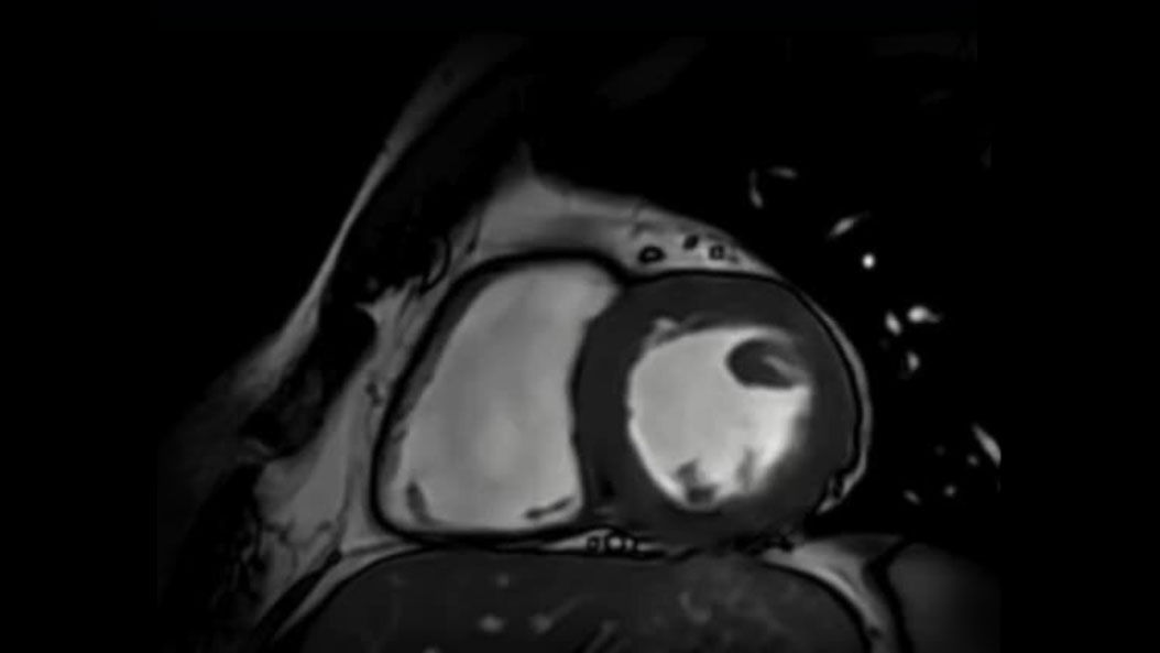 CardioImaging-product-switcher-desktop