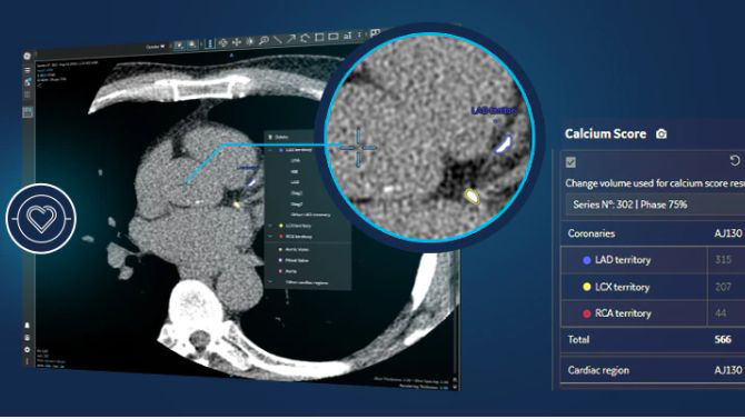 cardioiq-suite
