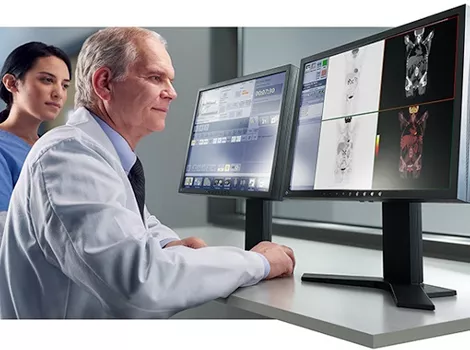 Cardiology Solutions Acute Coronary Syndrome discovery mi capability