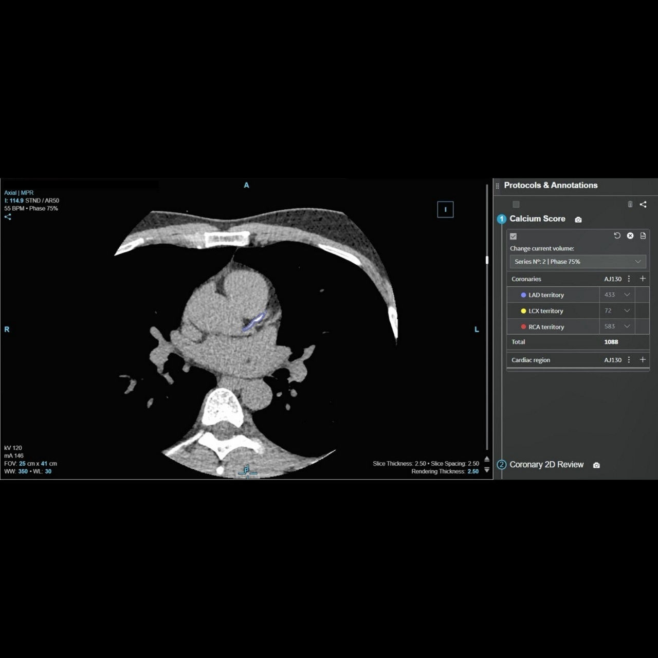 <u></u>CardIQ Suite
