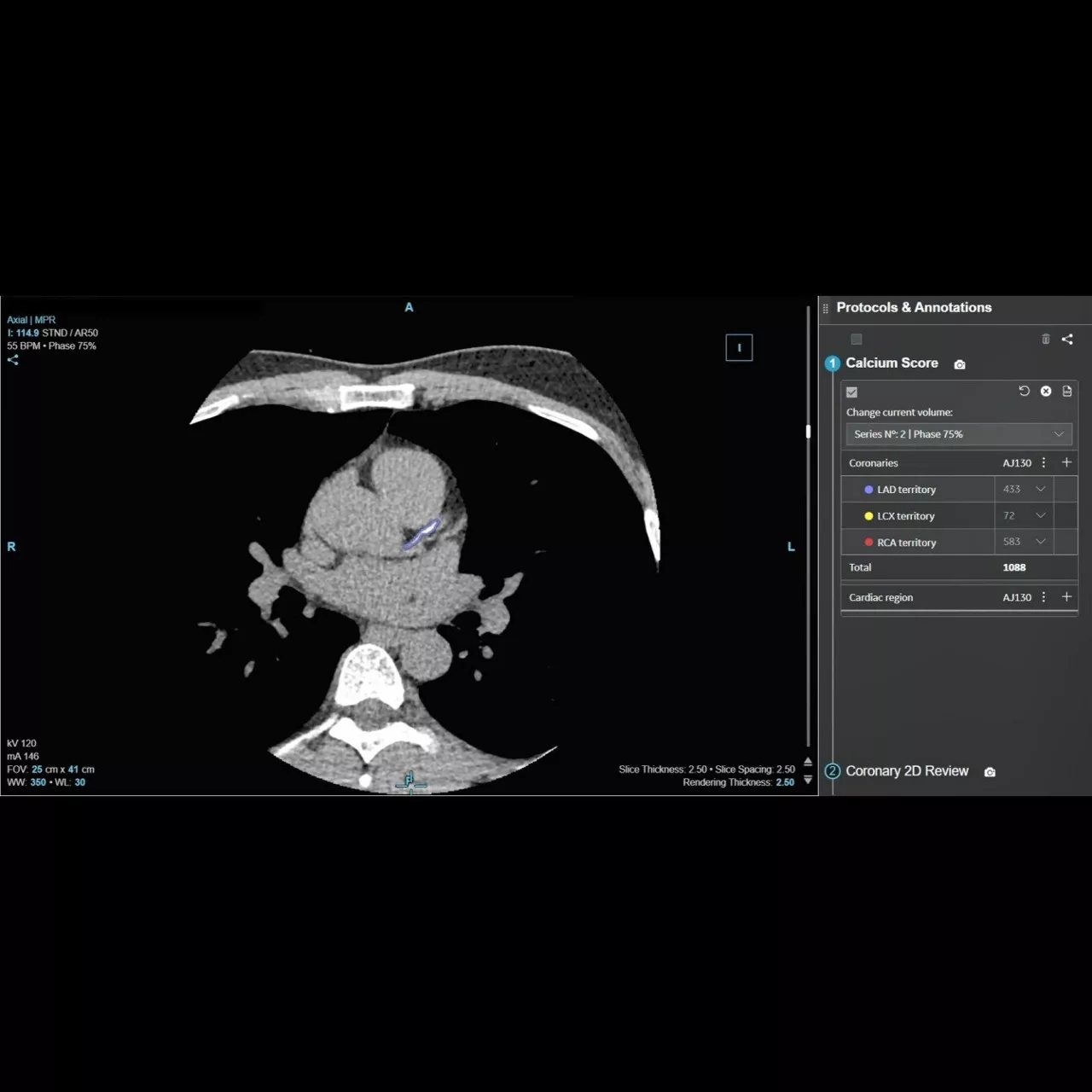 <u></u>CardIQ Suite
