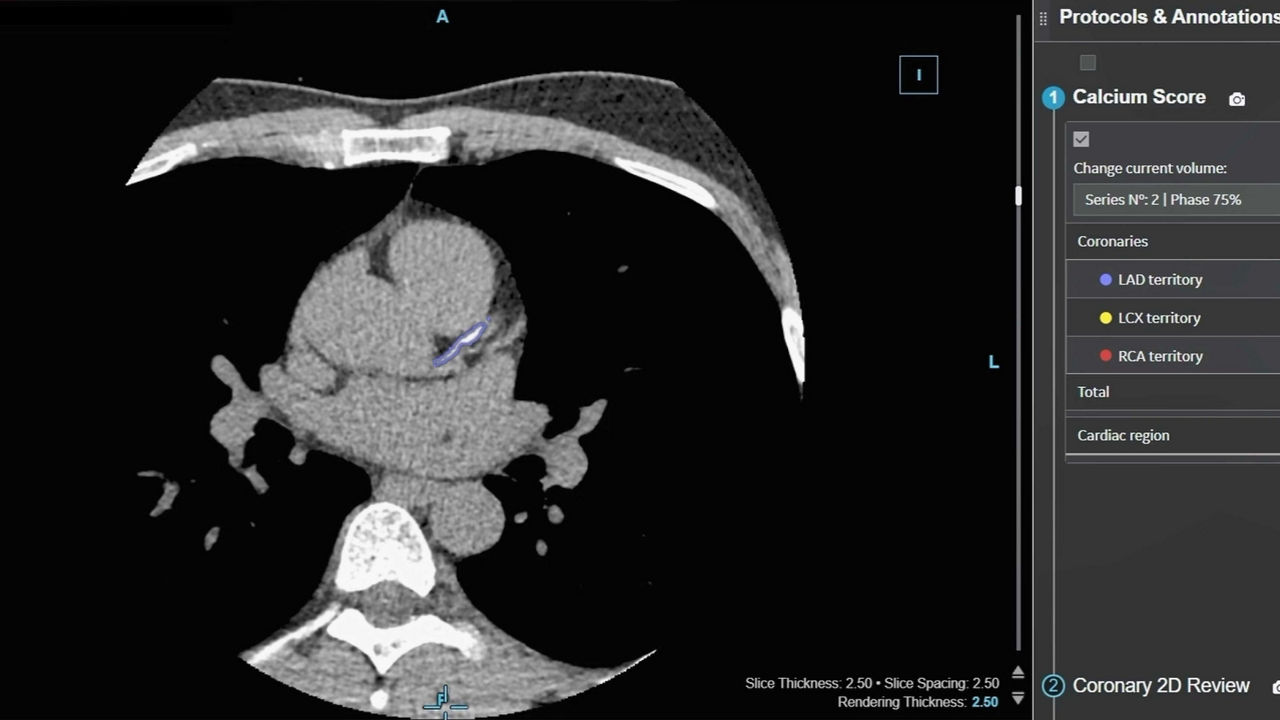 <p>CardIQ Suite</p>

