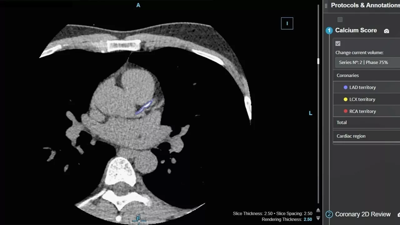 <p>CardIQ Suite</p>
