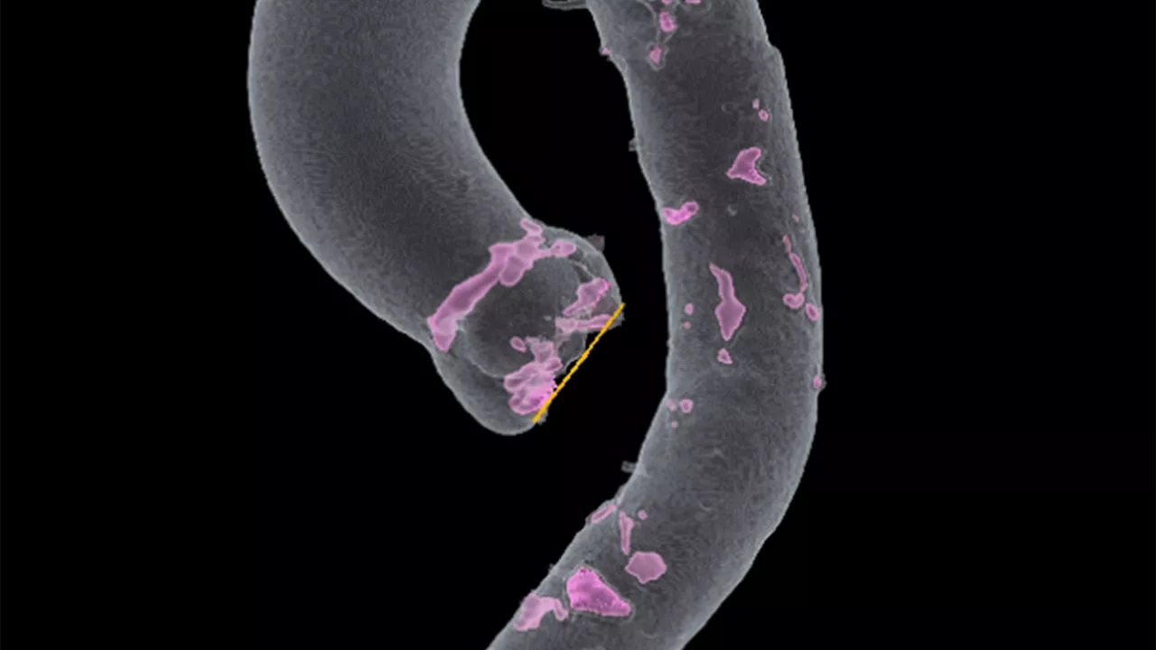 <p>TAVI Analysis</p>
