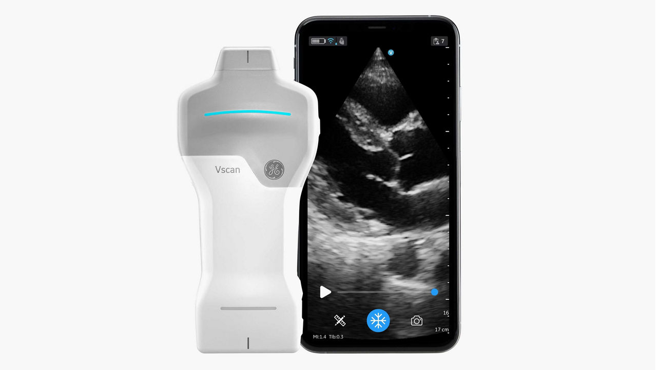 Handheld Ultrasound: Vscan Air ™ SL 