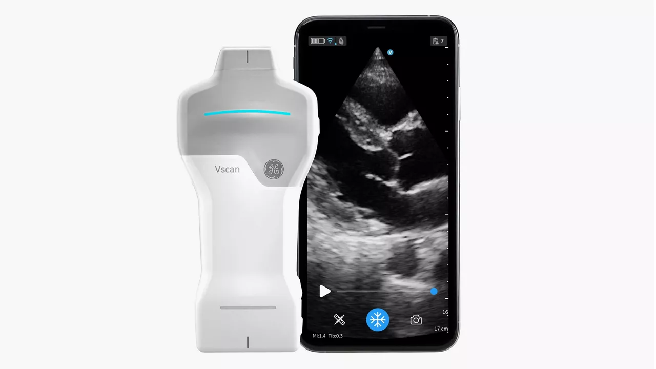 Handheld Ultrasound: Vscan Air ™ SL 