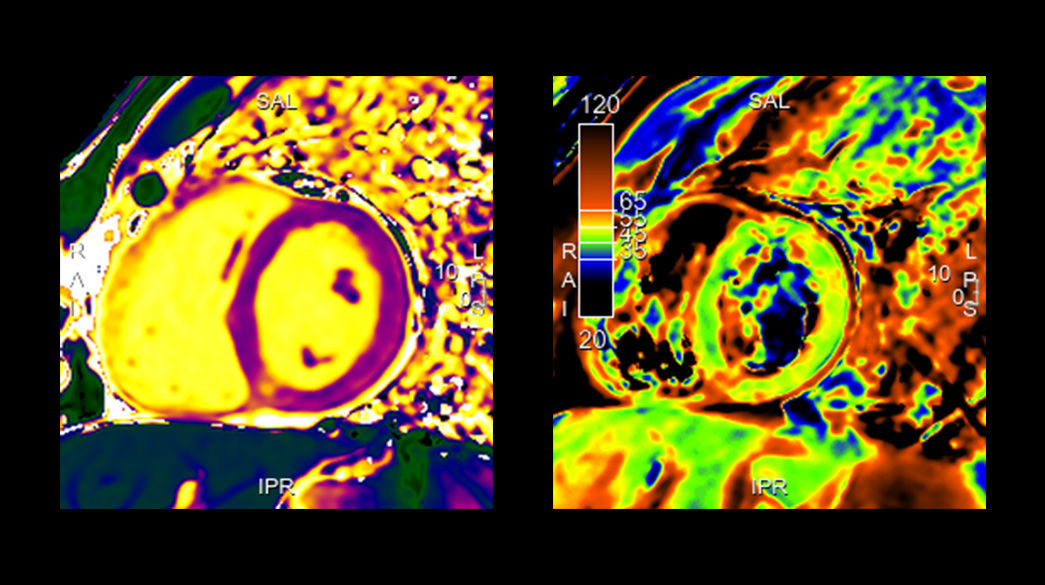 CardioMaps1040-x-585