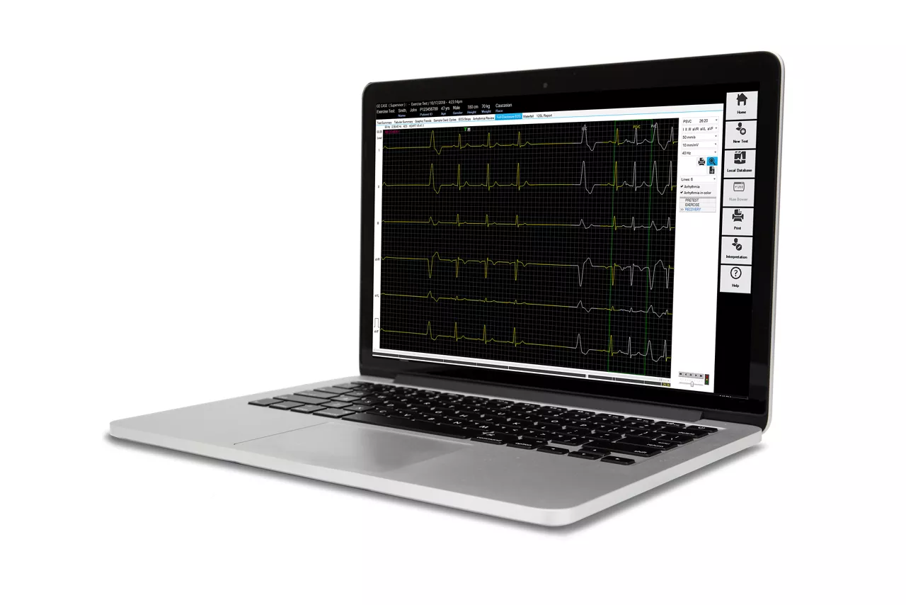 cardiosoft