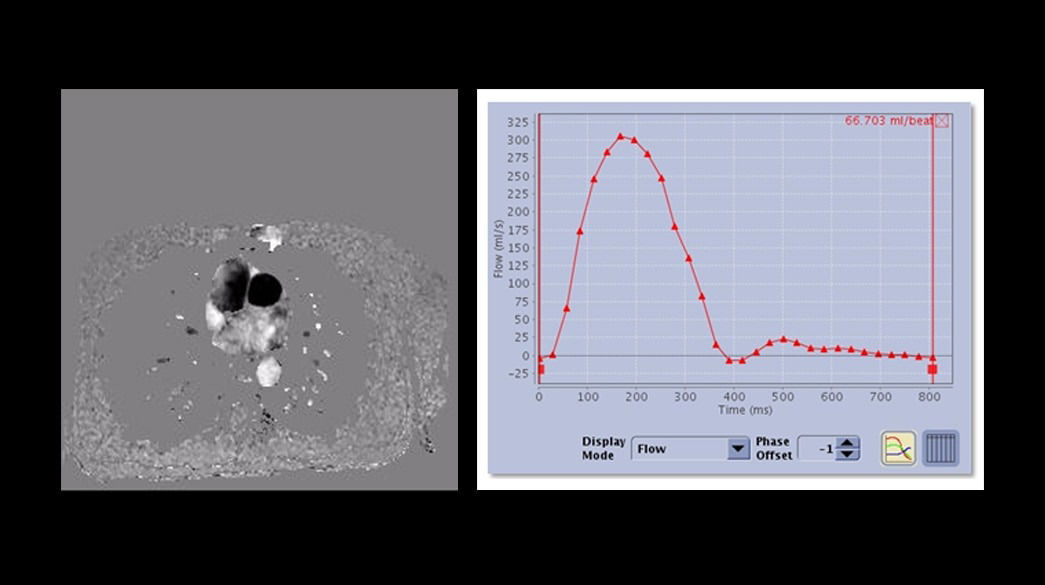 <p>2D Phase Contrast</p>
