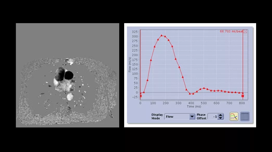 <p>2D Phase Contrast</p>
