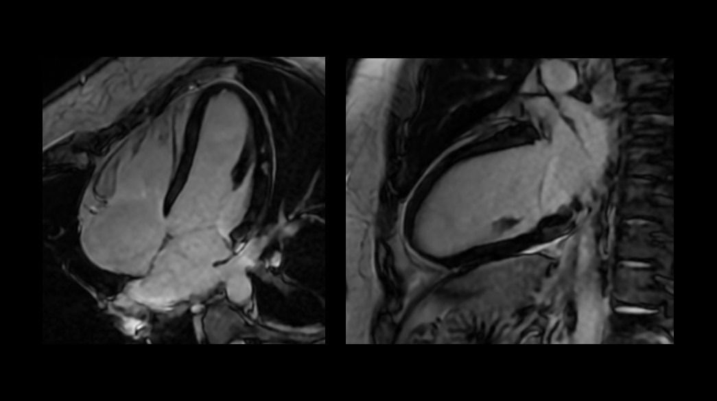 <p>MDE Plus – compatible with AIR™ Recon DL</p>

