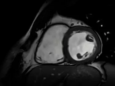 cardiovascular-imaging-for-signa-product-tile-ci-en