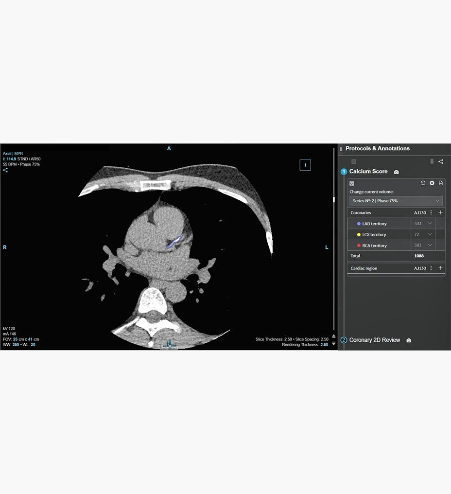 cardiq-suite-aw-deep-learning-ci-en