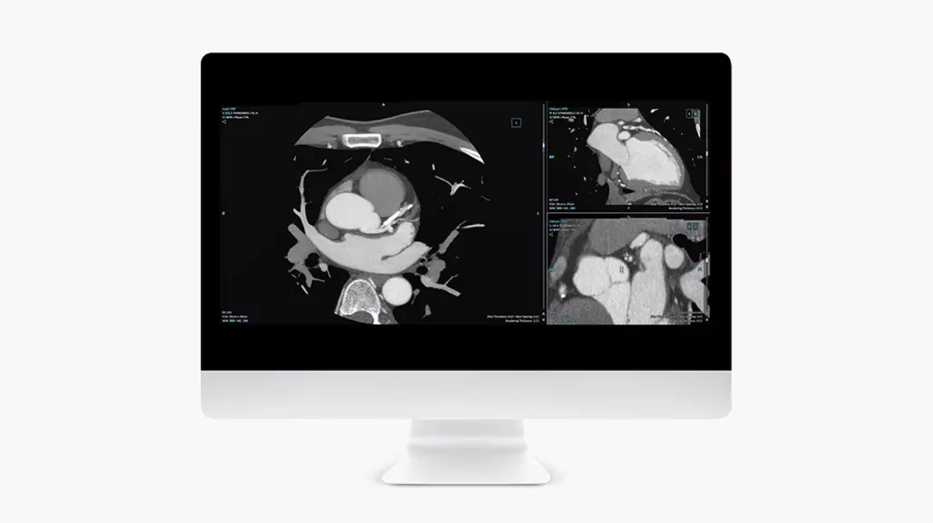 Cardiq Suite 1