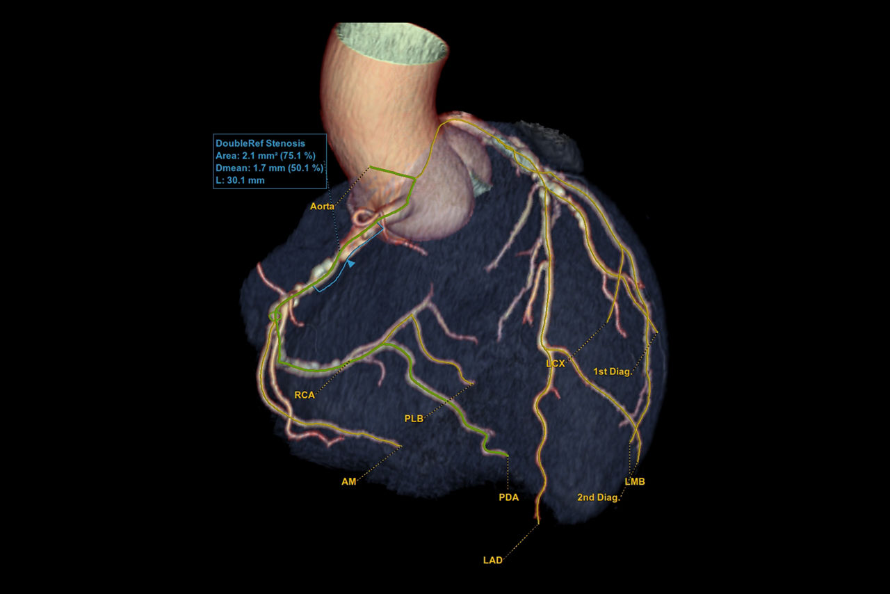 cardiqxpress20revealfeaturesheroimage