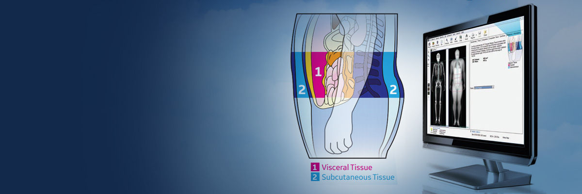 carescan-banner