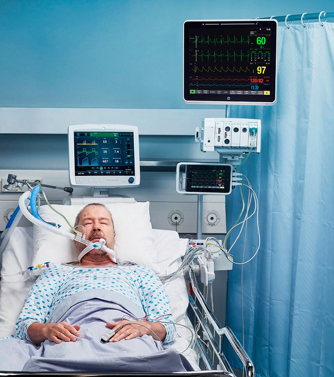 CARESCAPE-Canvas-ICU