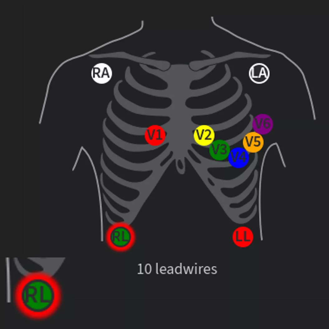 carescape-ecg-electrode-visualization-gallery-3