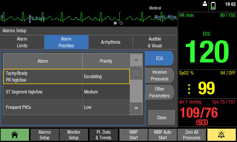 CARESCAPE-ONE-alarm-setup
