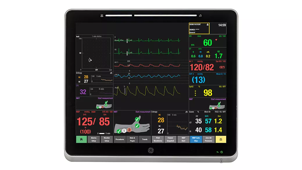 carescape canvas monitor screen