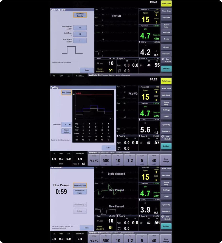 carestation-650c-automated-procedures-st-en