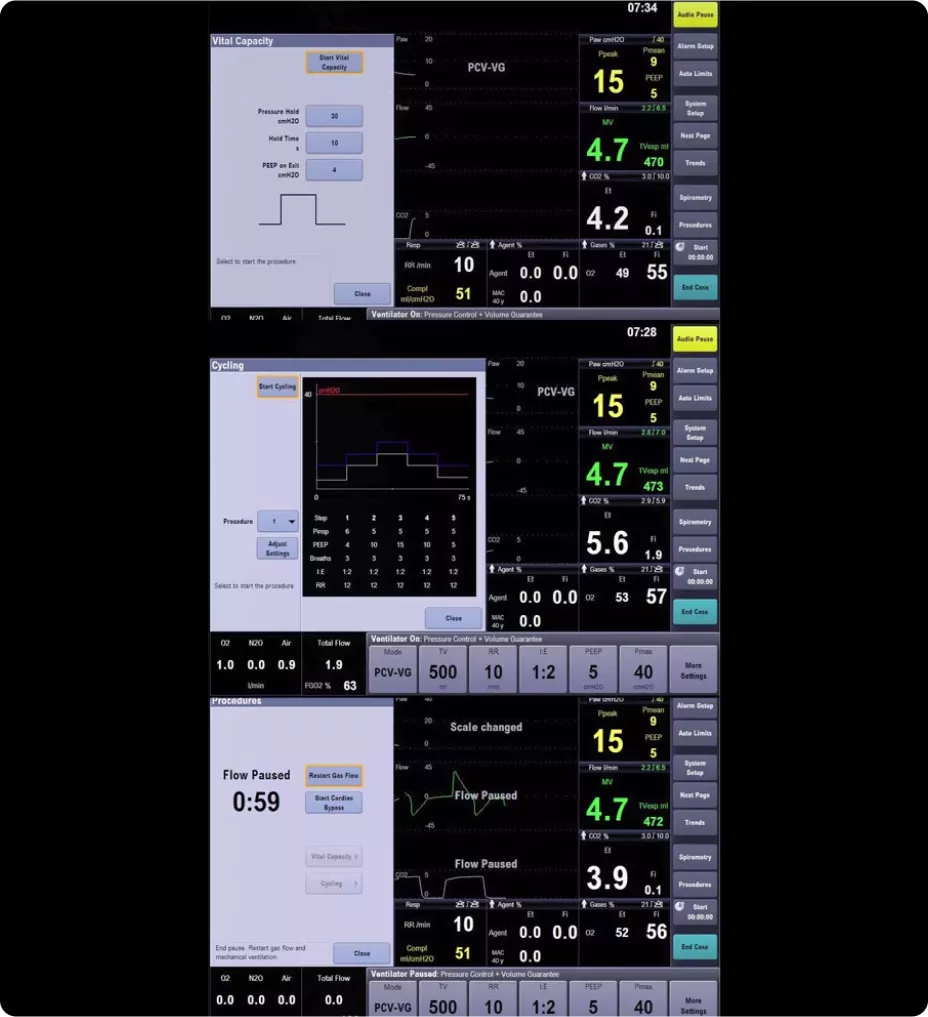 carestation-650c-automated-procedures-st-en