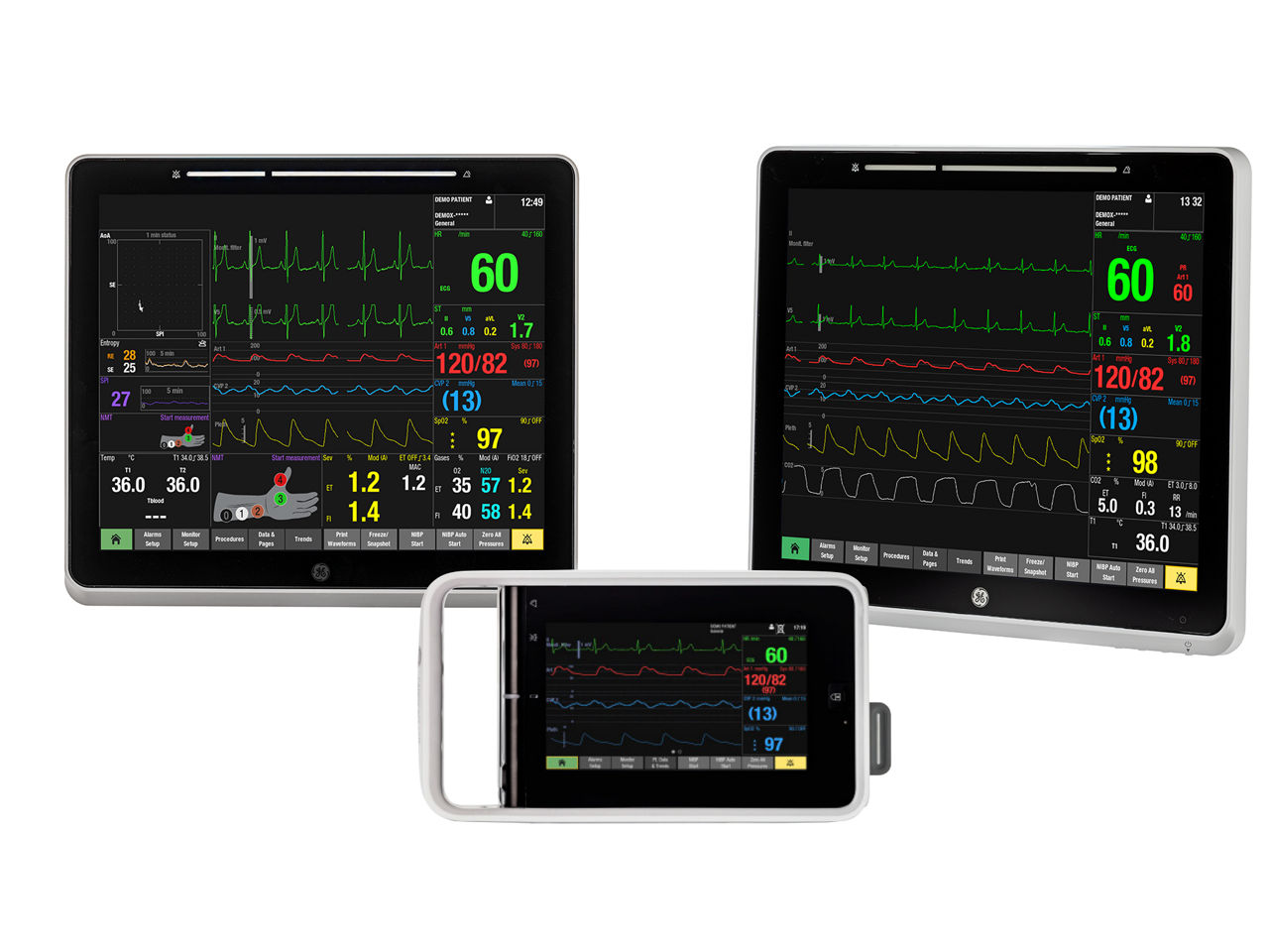 carestation-750-trusted-interface-ba-gb