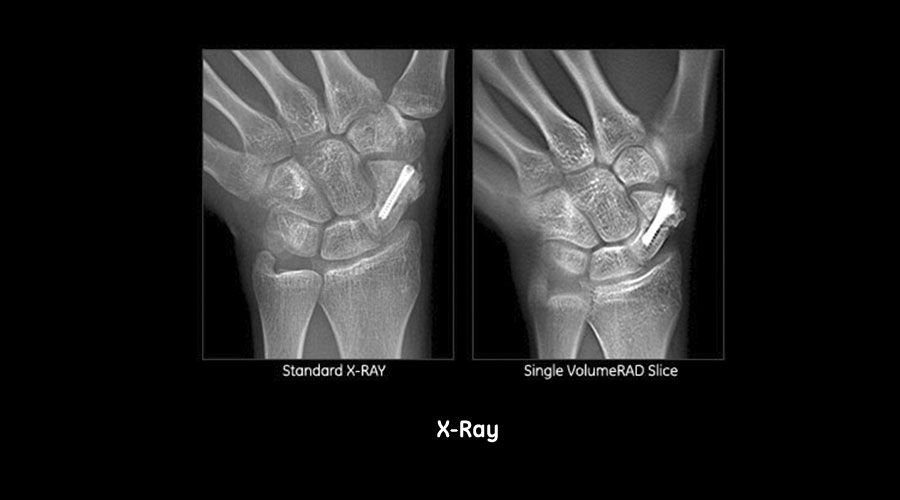 carousel-image-4-xray