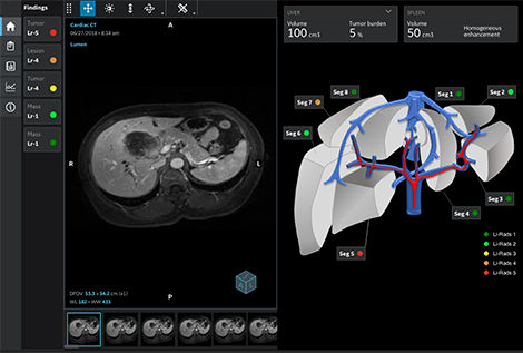 cas_usage_diagnostic_cancers_primitifs_foie