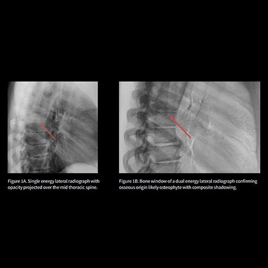 case-study-carousel-1-ci-en